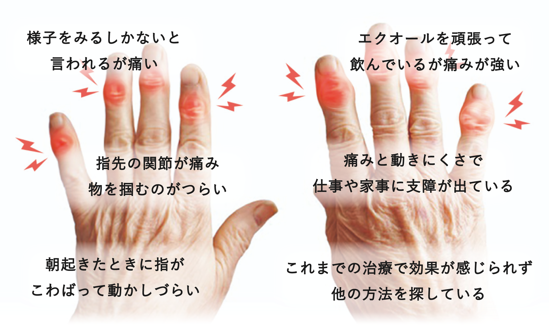 へ バーデン 結節 原因