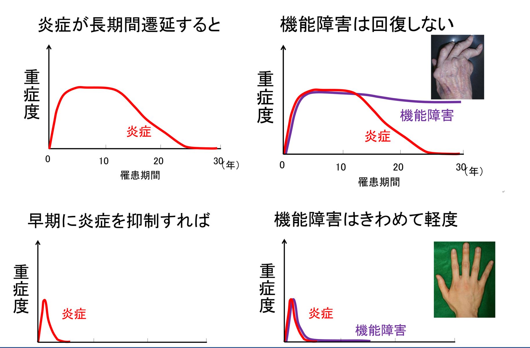 リウマチ専門医は私の健康のために何をしてくれるのでしょうか?